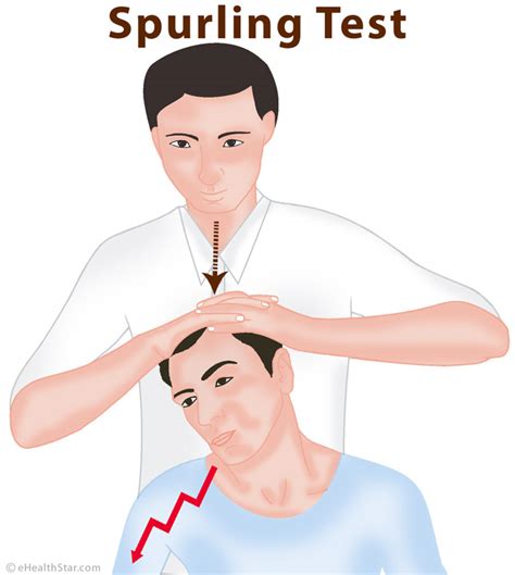 axial compression test procedure|positive spurling sign.